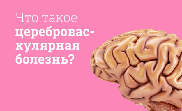 Что такое цереброваскулярная болезнь?